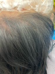 -熙朵美学植发·连锁品牌