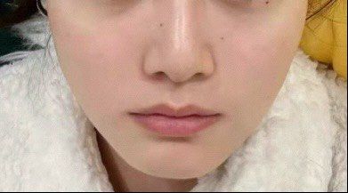 -洁铭新加坡医美