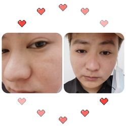 体验前-慕颜医疗美容·皮肤微整 抗衰