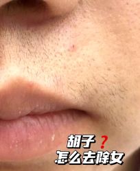 -薇兰专业脱毛连锁机构