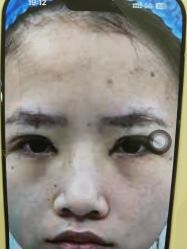 -长沙雅美医疗美容医院
