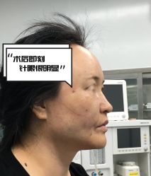 -素美医疗美容·西南眼鼻整形·修复基地