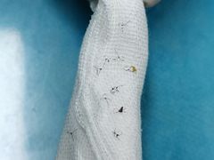 -美尔目眼科医院·近视手术·儿童近视(通州店)