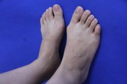 -圣嘉新医疗美容医院