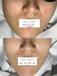 -美肤盾祛痘·问题肌头疗管理中心