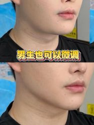 -深圳春天阳光医院·轮廓抗衰中心