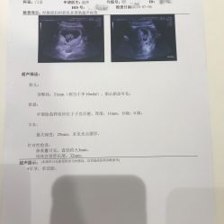 -重庆安琪儿妇产医院-妇幼保健联盟医院