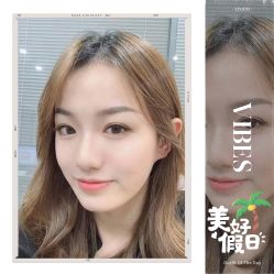 -大麦微针植发全国连锁
