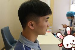 -大麦微针植发丨全国连锁