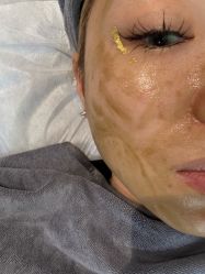 -skin79皮肤管理中心