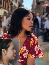 -北京米扬丽格医疗美容·联合丽格鼻整形中心