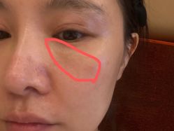 -广州美莱医疗美容医院