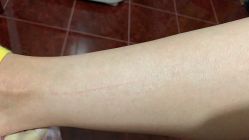 -上海玫瑰医疗美容医院