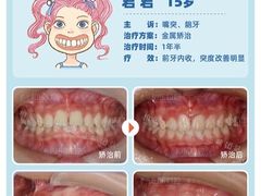 -柏乐口腔(南宁总院)