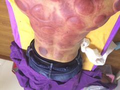 -沈师傅盲人按摩工作室(密三小区店)