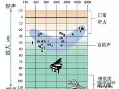 -自然之声助听器·呼吸机(东风大街店)