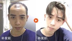 -极客侠男士假发定制补发