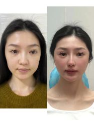 -上海伊莱美医疗美容医院