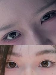 -洁铭新加坡医美