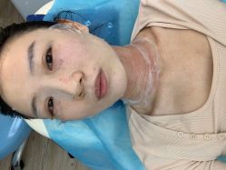 -小忠丽格医美