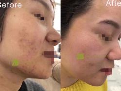 -E.beauty驻颜·痘敏肌调理中心