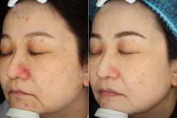 -苑苑vbeauty科技美容SPA