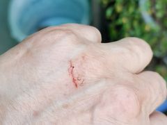 -杭州市第三人民医院