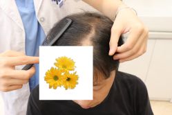 -大麦微针植发丨全国连锁