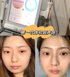 -温州伯思立医院