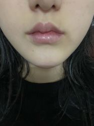 -厦门美莱整形美容医院