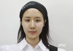 -石家庄苏亚美联臣医疗美容医院