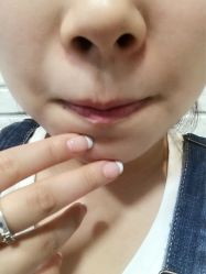 -咪咪比基尼脱毛专业店