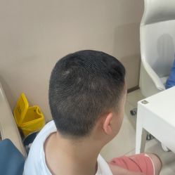 -大麦微针植发丨全国连锁