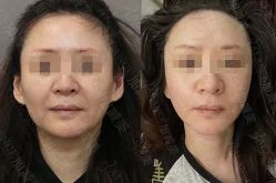 -加减美医美连锁品牌