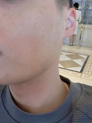 体验后-南宁华美医疗美容医院