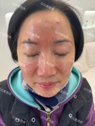 -SOS修丽可.痘肌修复中心