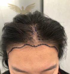 -熙朵美学植发·连锁品牌