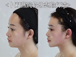-Yestar宁波艺星整形医院