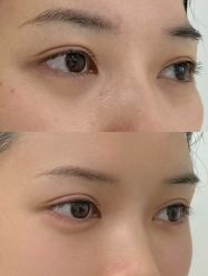 -Yestar重庆艺星医疗美容医院