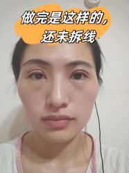 -素美医疗美容·西南眼鼻整形·修复基地