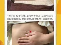 -名医堂永康中医·推拿正骨·针灸·艾灸