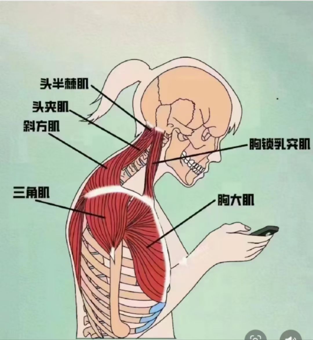 头颈半棘肌的起止点图片