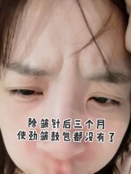 -安徽合肥韩美整形外科医院