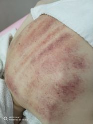 -苑苑vbeauty科技美容SPA
