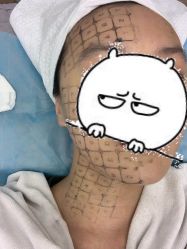 点击看大图 -小忠丽格医美