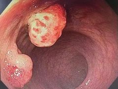 -中国人民解放军总医院