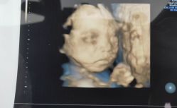 点击看大图 -重庆安琪儿妇产医院-妇幼保健联盟医院