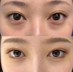 点击看大图 -DMK酶疗中心·BeautyYoung舒妍科技美肤
