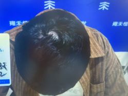 -雍禾植发全国连锁