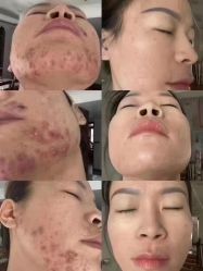 -skin79皮肤管理中心